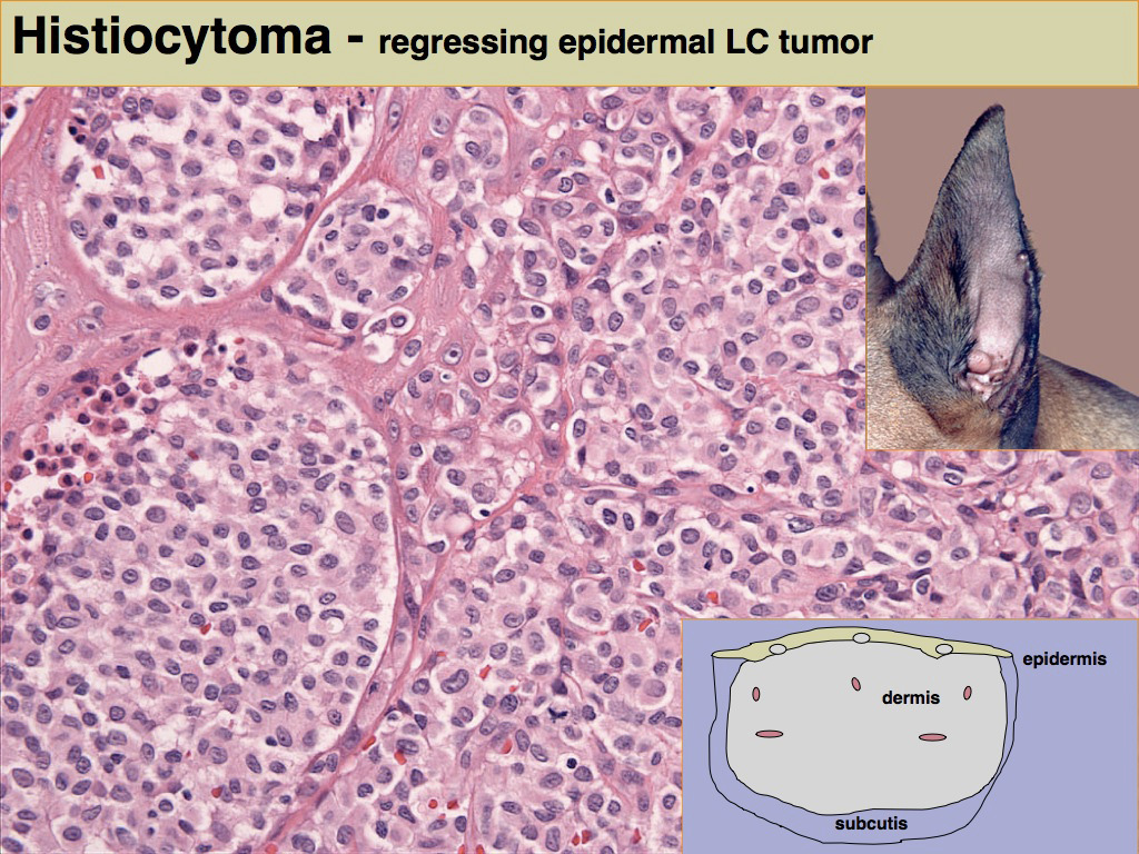 Fig. 3. Multiple histiocytomas on the margin of the pinna and in the ear canal; Drawing emphasizes the epidermal focus of histiocytomas; HE section of histiocytoma with intra-epidermal invasion